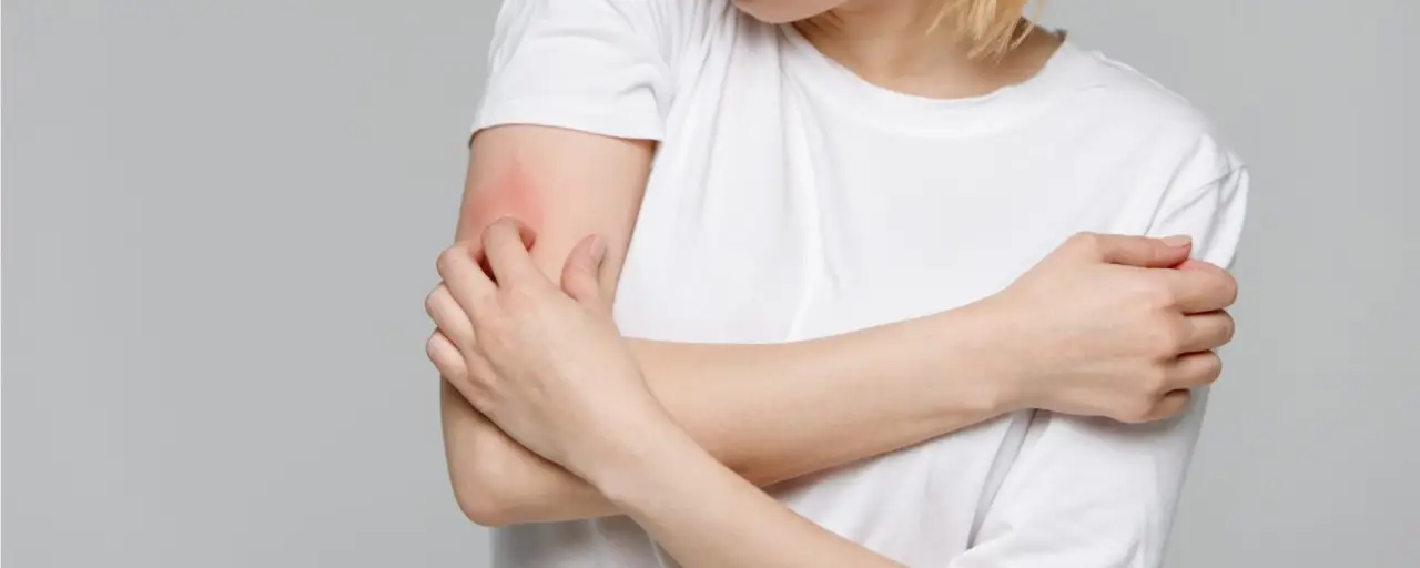 Psoriasi? Non usare creme a caso: ecco quali funzionano davvero e quali peggiorano la situazione