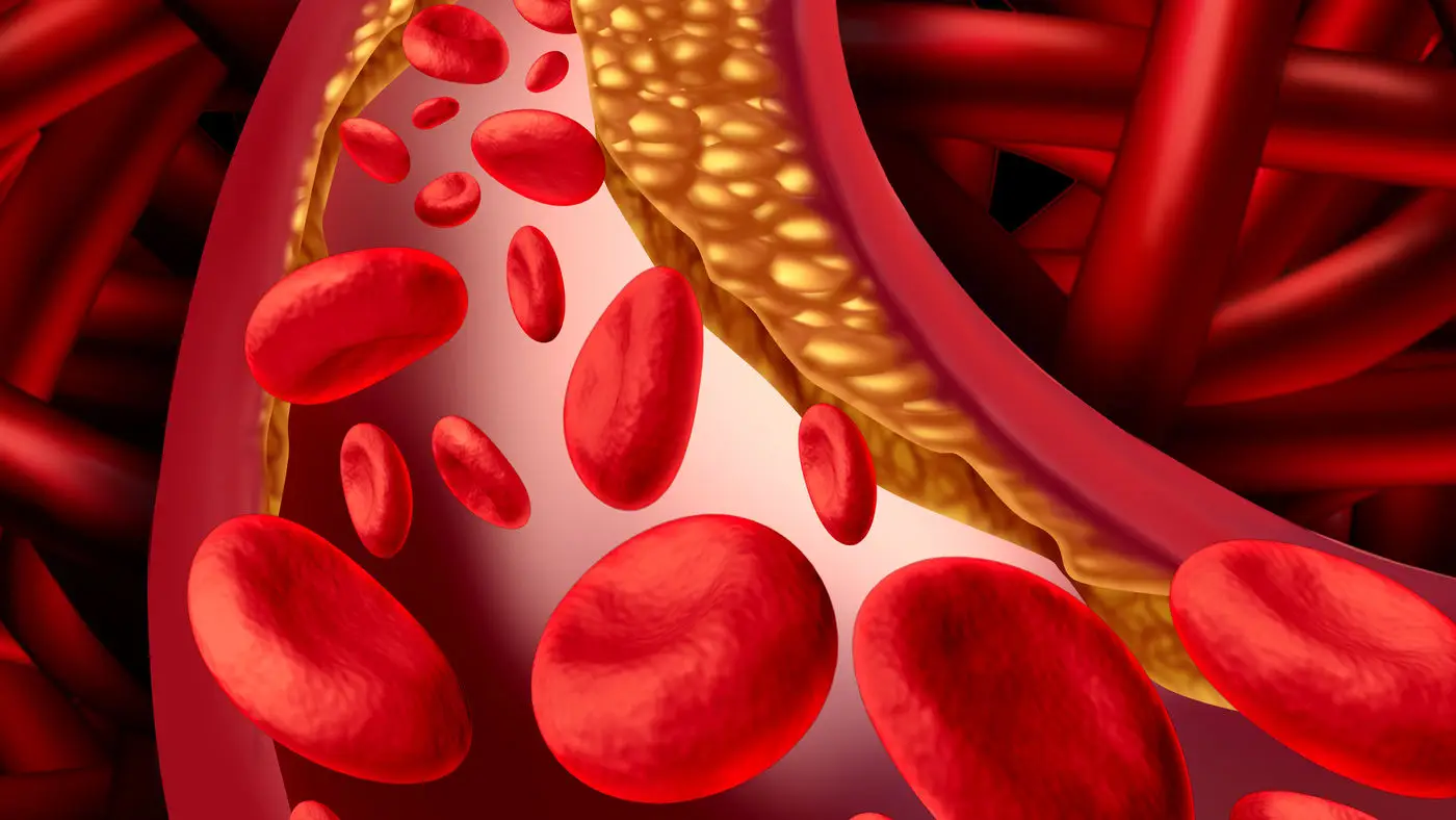 Ti sentirai in salute ma il tuo rischio vascolare potrebbe essere altissimo: ecco cosa significa